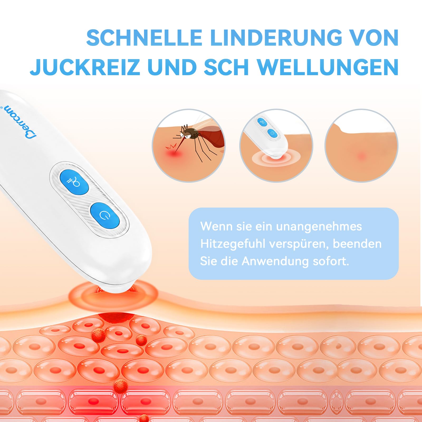 berrcom-insektenstichheiler-elektronisch-hitzestift-mit-2-stufen-ohne-chemie image 2